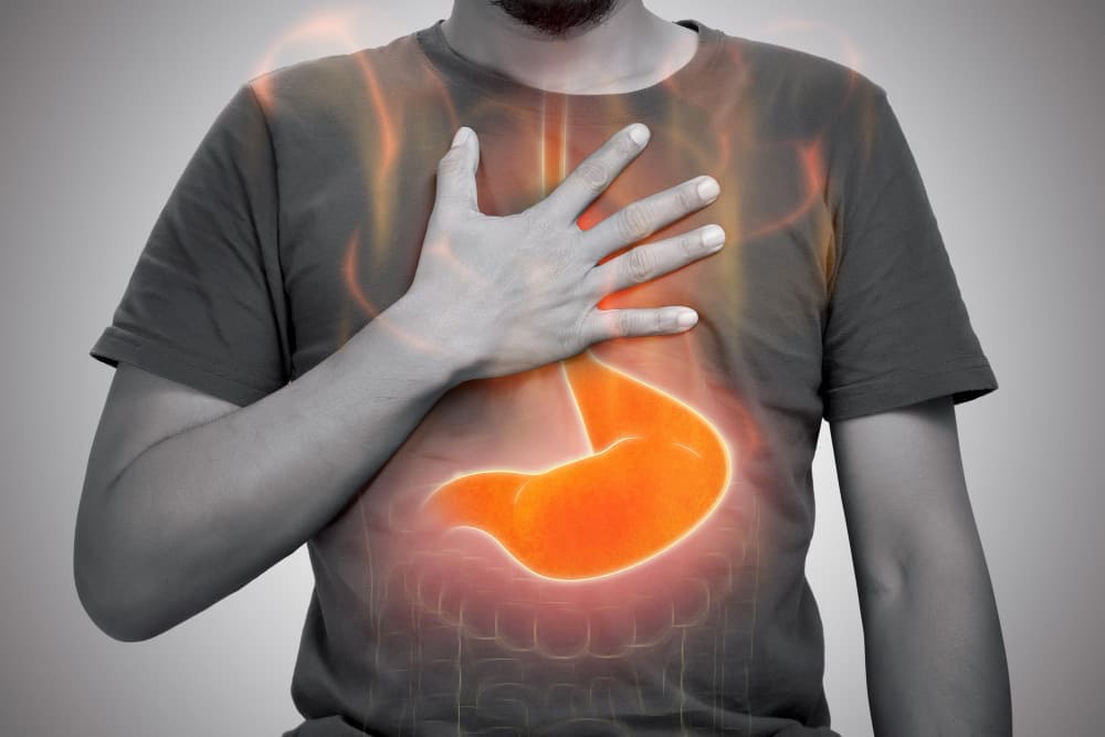 Cirugía antirreflujo de alta precisión en CDMX y Estado de México: Tratamiento avanzado para el reflujo gastroesofágico